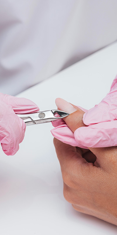 deposeOngle2 Dépose professionnelle d'ongles